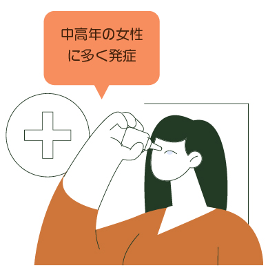 シェーグレン症候群のイメージイラスト
中高年の女性に多く発症