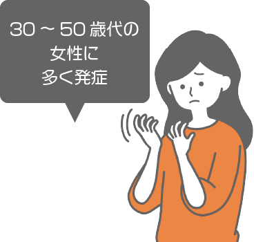 リウマチは、30～50歳代の女性に多く発症のイメージイラスト